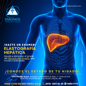 Elastografía hepática